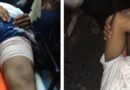 Agente de la Policía Nacional es herido al ser sorprendido atracando en Los Ríos