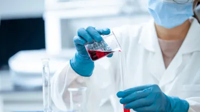 Un análisis de sangre podría detectar cáncer antes de que aparezcan síntomas