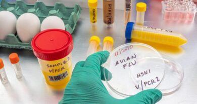 Detectan en España el primer caso de gripe aviar en humanos