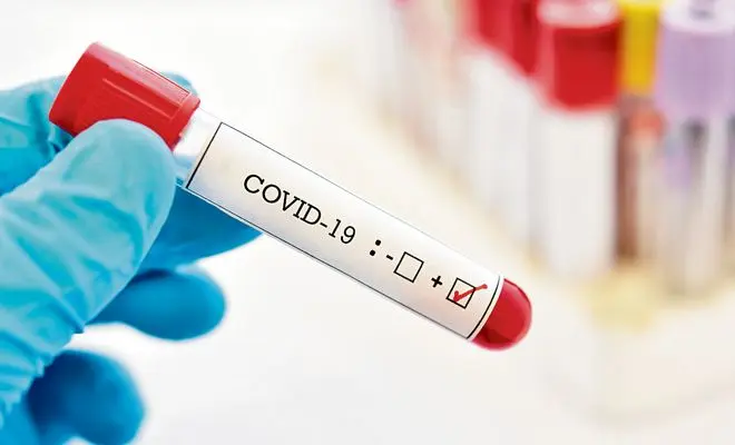 Salud Pública notifica 273 casos nuevos de covid-19