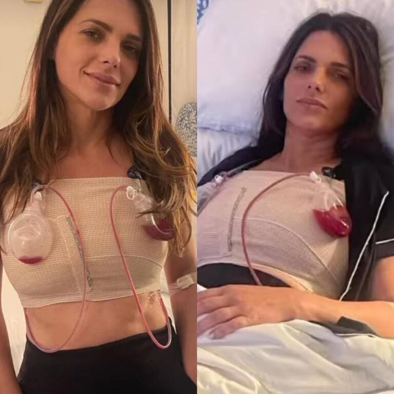 Síndrome de Asia, la rara enfermedad que afectó a la periodista Bárbara Bermudo