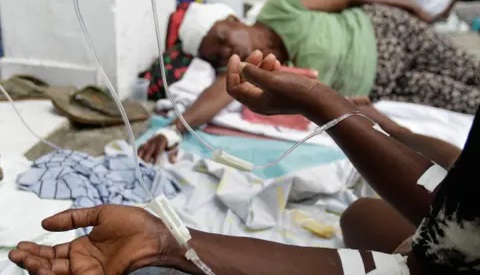 Brote de cólera en Haití deja más de 700 muertos desde octubre