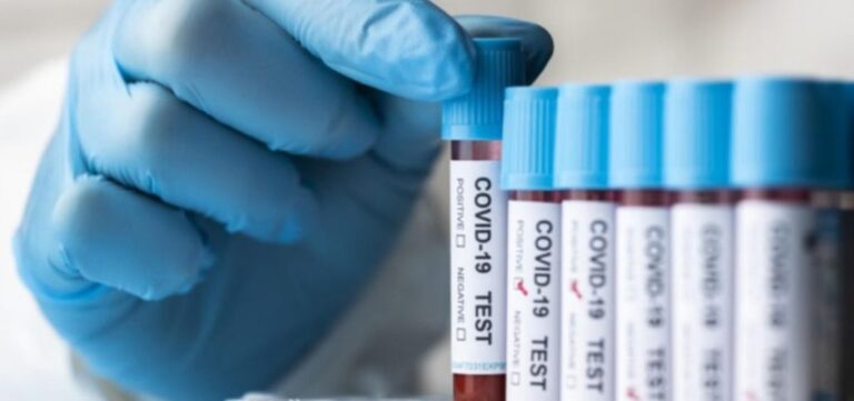 Salud Pública reporta 273 nuevos casos de covid en la última semana