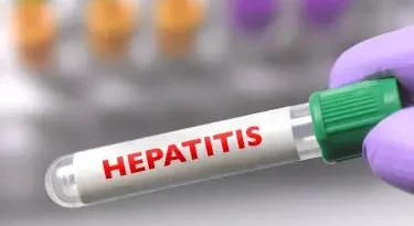 OMS: La hepatitis podría ser más letal que la malaria, la tuberculosis y el sida en 2040
