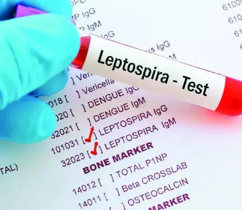 Casos de leptospirosis se elevan 74%; suman 585