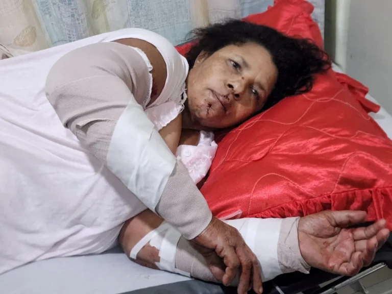 Dos perros pit bulls atacan a una mujer en Santiago