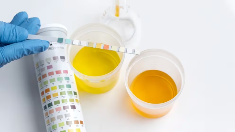 Por qué el color de la orina es un indicador clave sobre la salud