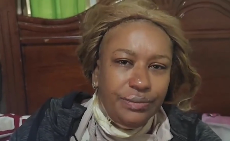 Mujer a la que su expareja le prendió fuego: «Temo por mi vida y la de mi hija»