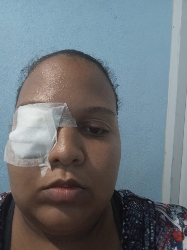 Joven necesita ayuda para prótesis ocular