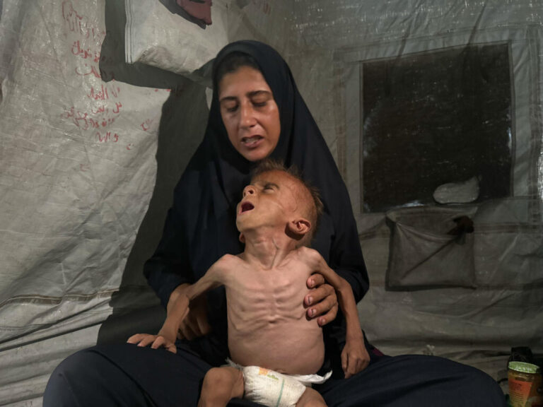 Enfermos y desnutridos, los niños de Gaza que Israel llama 'fake news' también pasan hambre