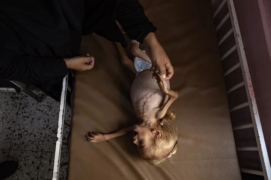 Muertes por hambre en Gaza se disparan: 185 fallecidos en agosto