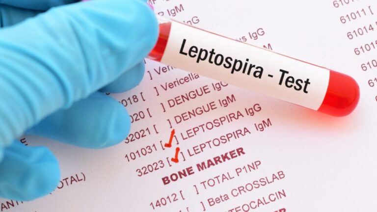 República Dominicana reporta 11 nuevos casos de leptospirosis tras paso de la tormenta Melissa