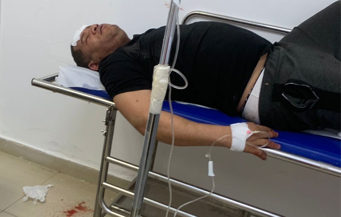 “Mantequilla” resulta herido tras confuso incidente en carretera de Monte Plata